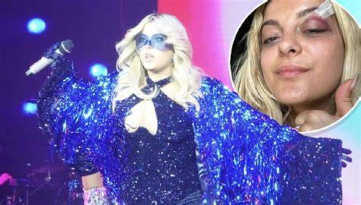 Bebe Rexha Wears Protective Eye Cover During Her Recent Concert After Being Hit by a Phone! Bebe Rexha Wears Protective Eye Cover During Her Recent Concert After Being Hit by a Phone!