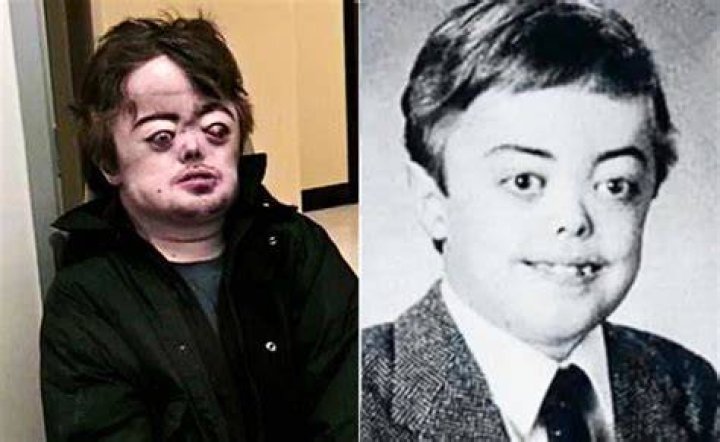 Brian Peppers 
