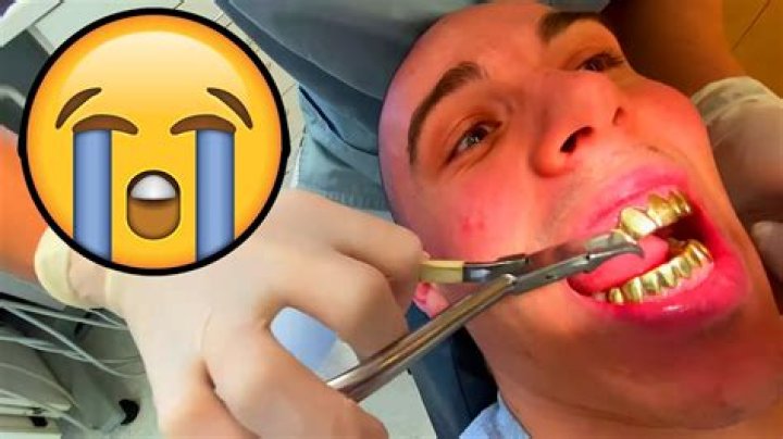 Can you take out permanent grills?