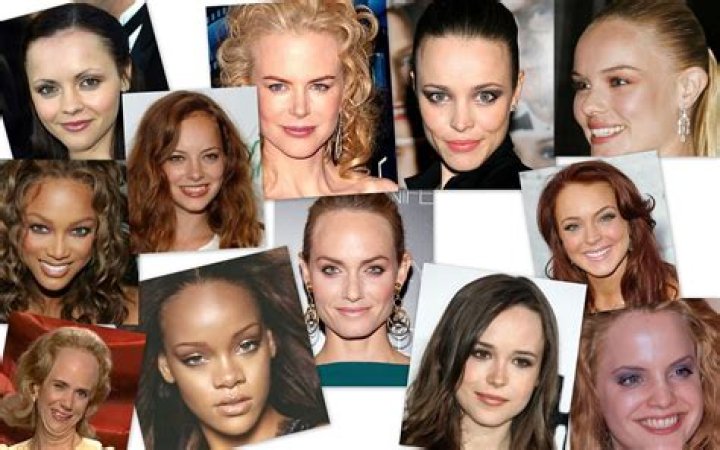 Celebrities With Big Foreheads