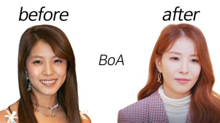 Did BoA Kwon Get Plastic Surgery?Who is BoA Kwon?