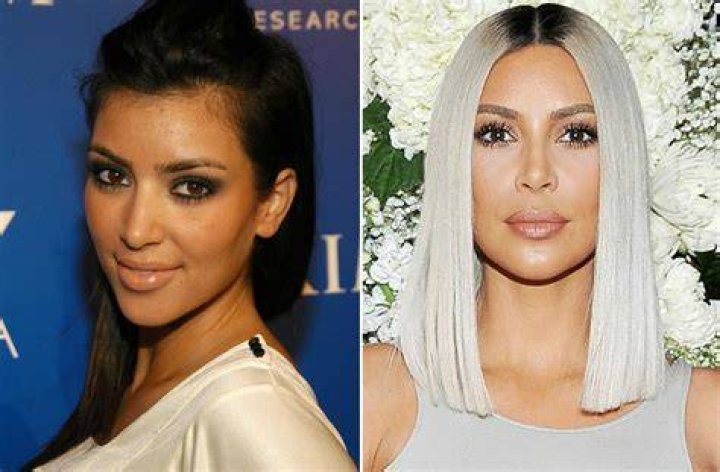 Did Kim Kardashian remove her breast implants?