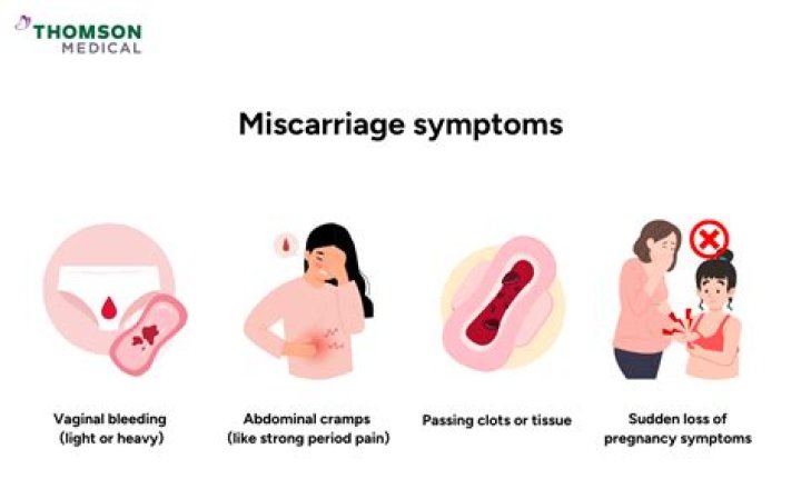 Does dancing cause miscarriage?