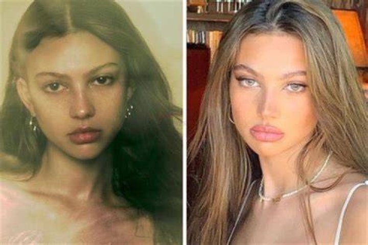Has Katarina Deme Done A Plastic Surgery?