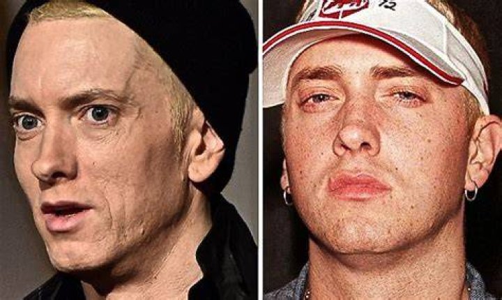 Is Eminem Still Alive Or Dead?