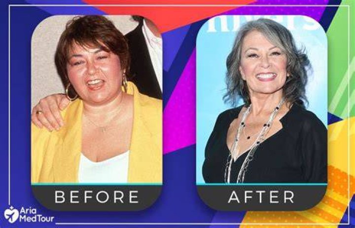 Roseanne Barr Surgery