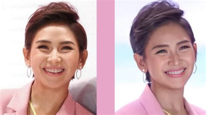 Sarah Geronimo plastic Surgery