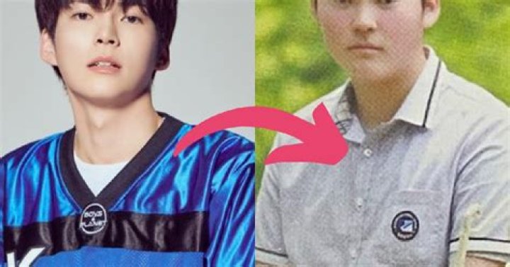 Sung Hanbin Plastic Surgery